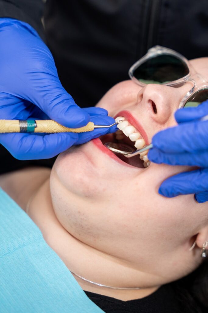 broken or knocked-out tooth in garneau, edmonton