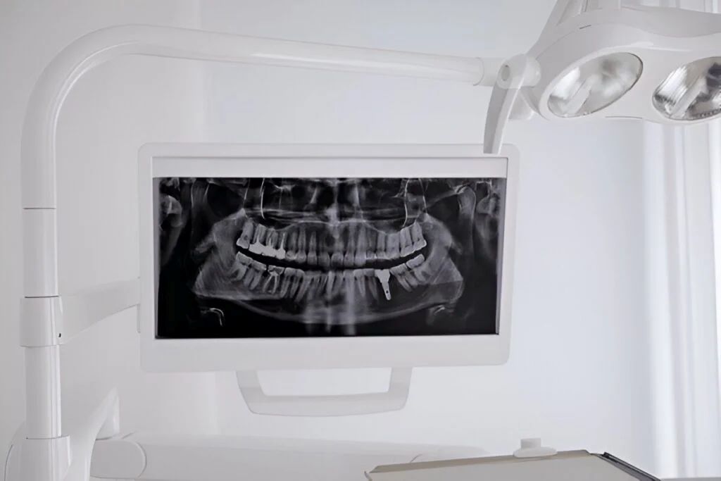 digital x rays intraoral scans near you