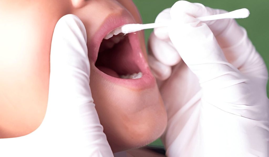 fluoride treatment in garneau