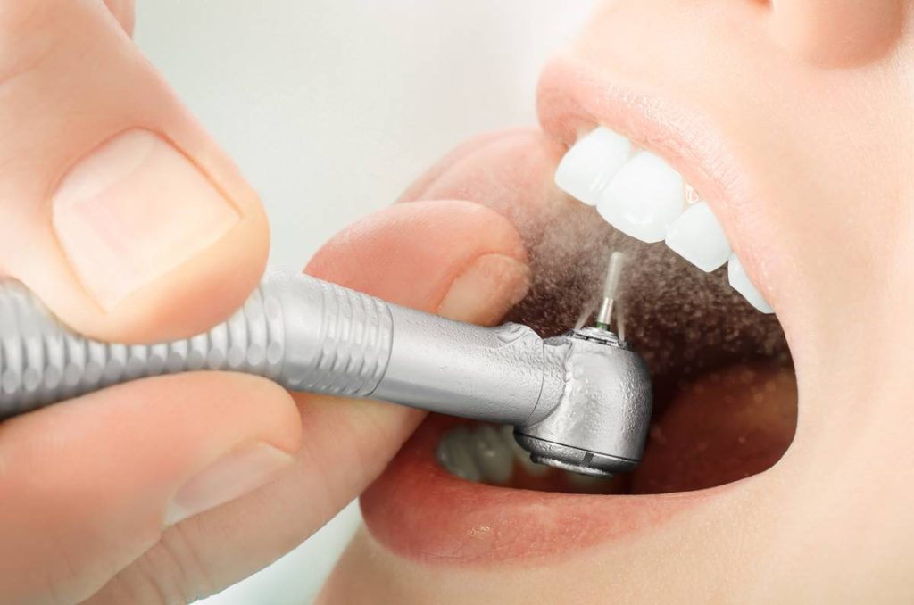 how teeth cleaning helps prevent tooth decay and bad breath